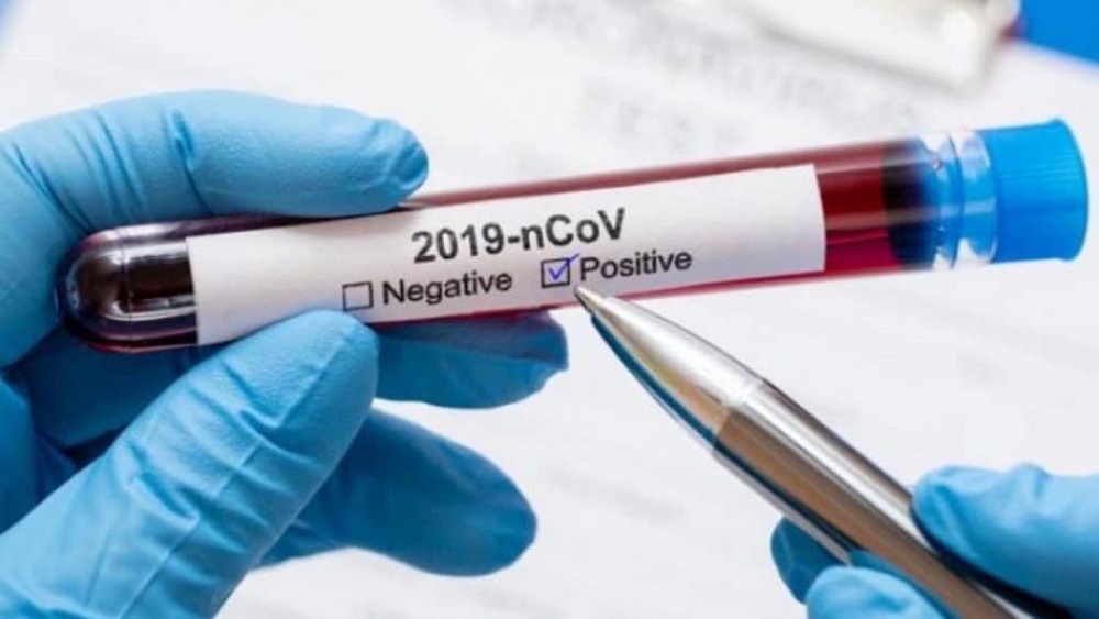 Eight New Cases Of Covid 19 In Malta TVMnews mt